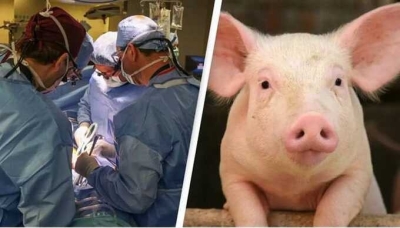 Впервые в истории человечества живому человеку была пересажена почка от свиньи